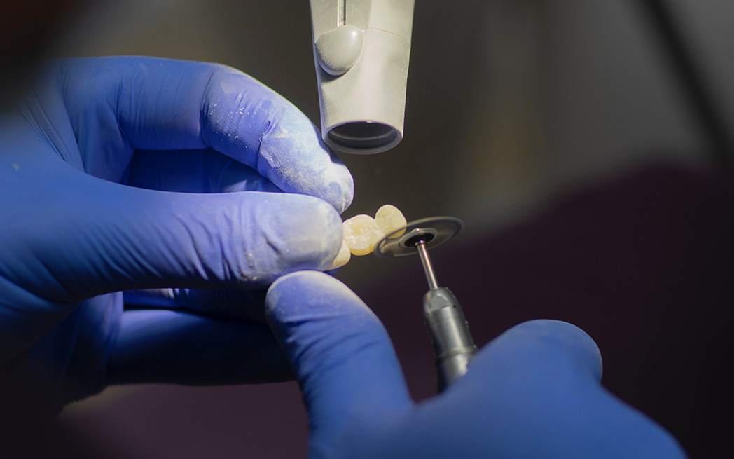 Dental procedure - photography: Elena Mozhvilo