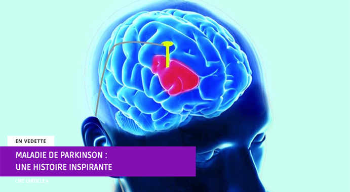 Parkinson