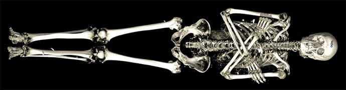 Visualisation du squelette d’Irthorru, Basse Époque, 26e dynastie, vers 600 av. J.-C., EA 20745. © The Trustees of the British Museum – WestmountMag.ca